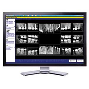 Digital X-rays Emergency Dentistry Louisville KY