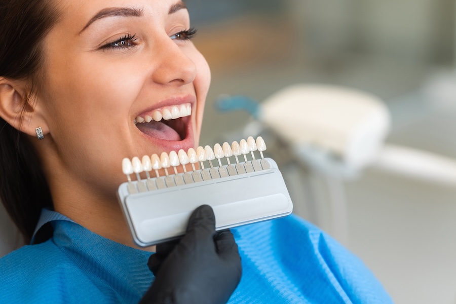 teeth whitening shade guide